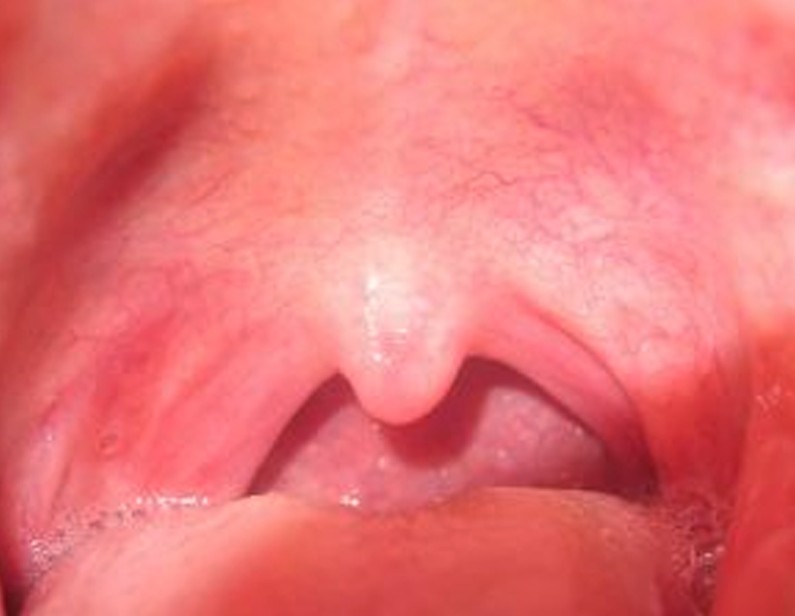 Pictures Of Step Throat 6