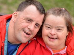 Down Syndrome downs syndrome